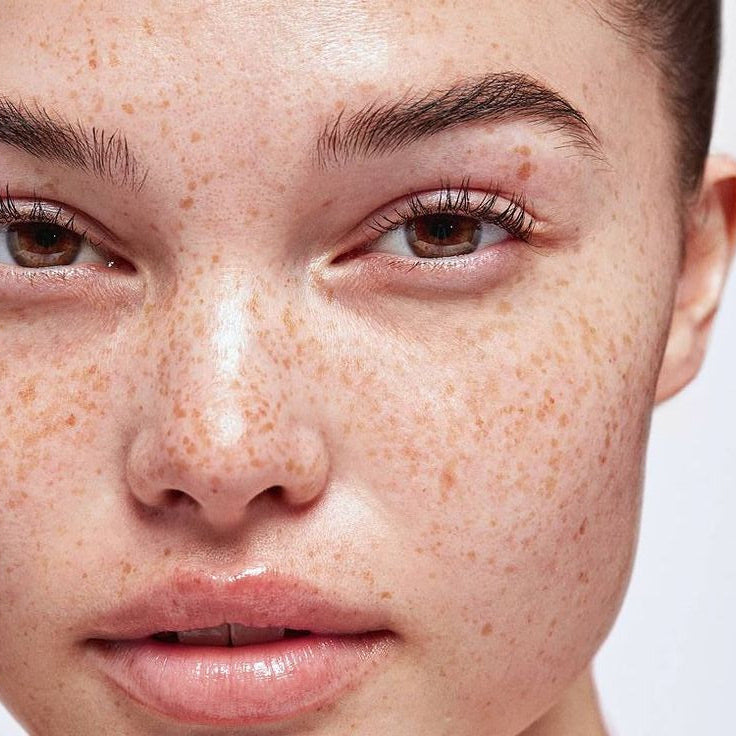 Facial Add On: Any Peel