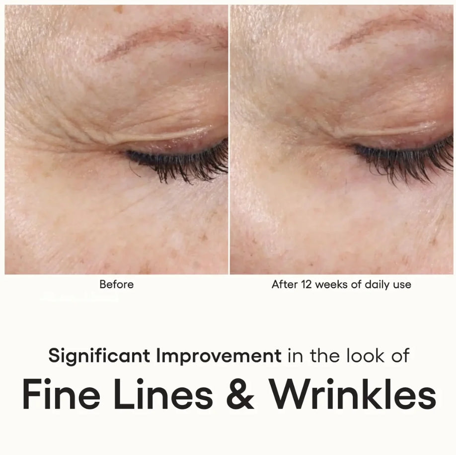 INTENSE Serum