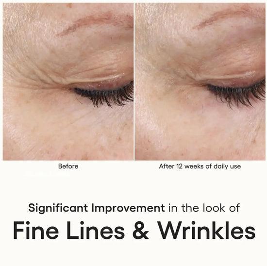 INTENSE Serum