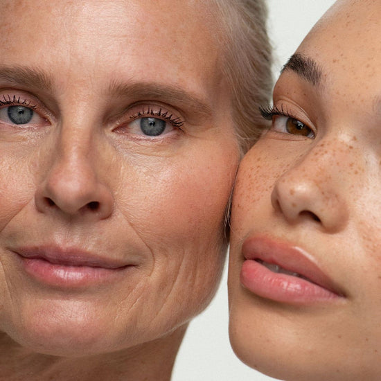 Sculptra Package- 2 Vials