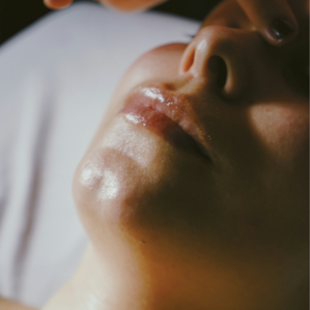 Microneedling with Salmon DNA (Rejuran)